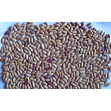 Exporting Grade Light Speckled Kidney Bean 200-240/G